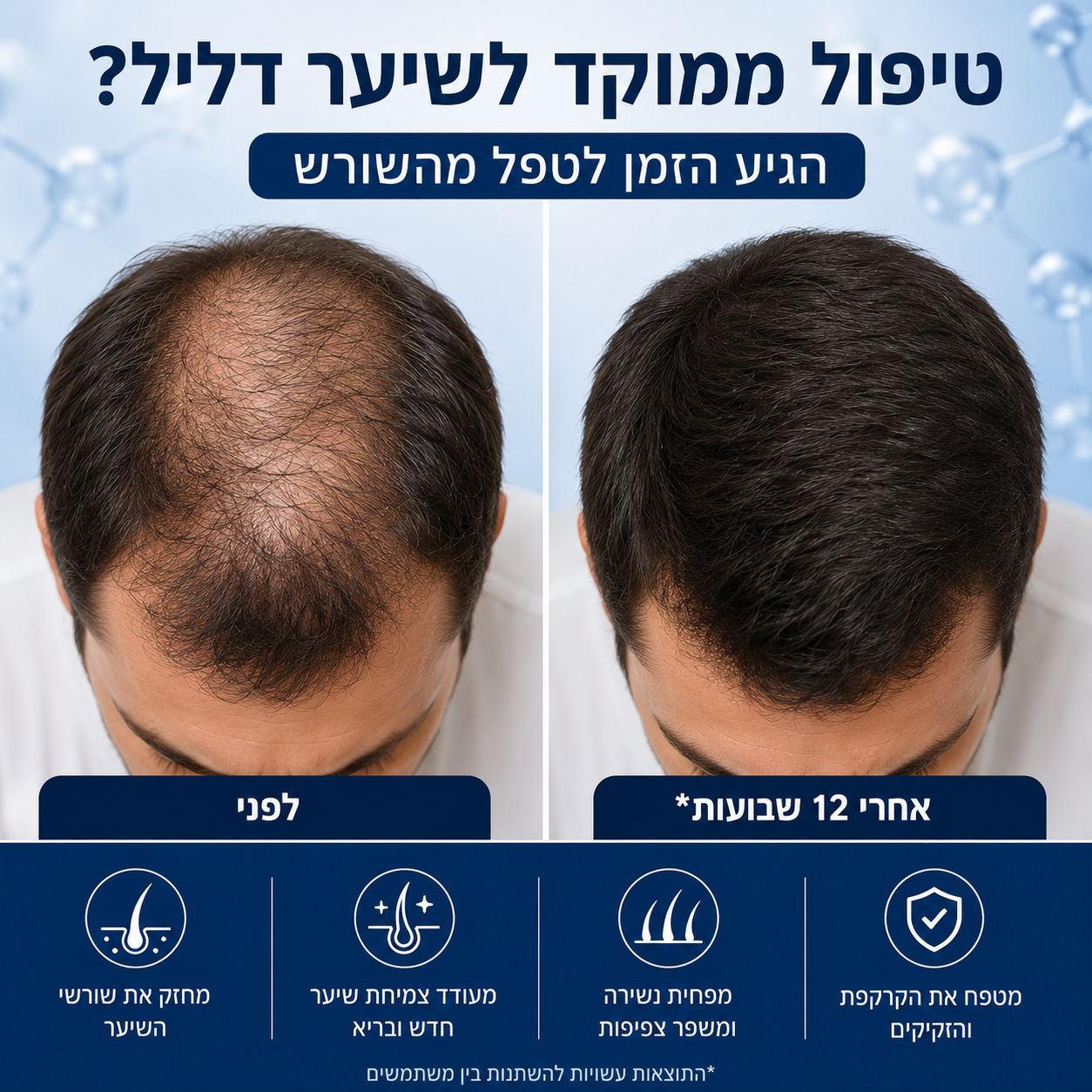 סרום פפטידים לצמיחת שיער