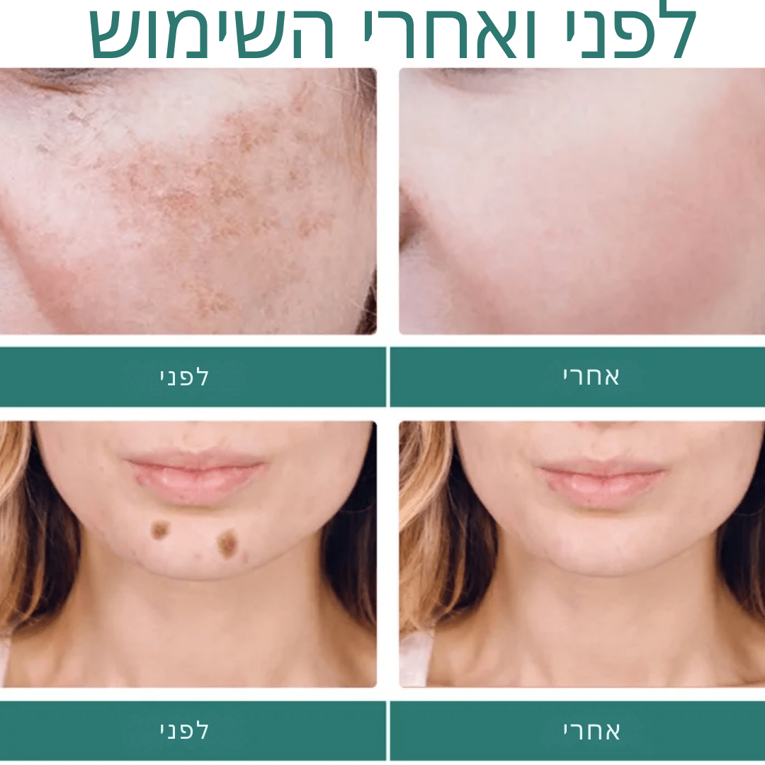 GlowPure - הקרם המהפכני למראה עור זוהר ואחיד | קרם הבהרת העור | אוזו - שופ