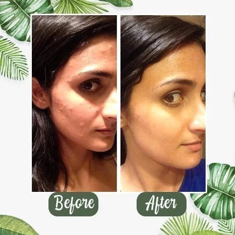 מסכה לניקוי עמוק וללא נקבוביות | Cleanse Mask | אוזו - שופ