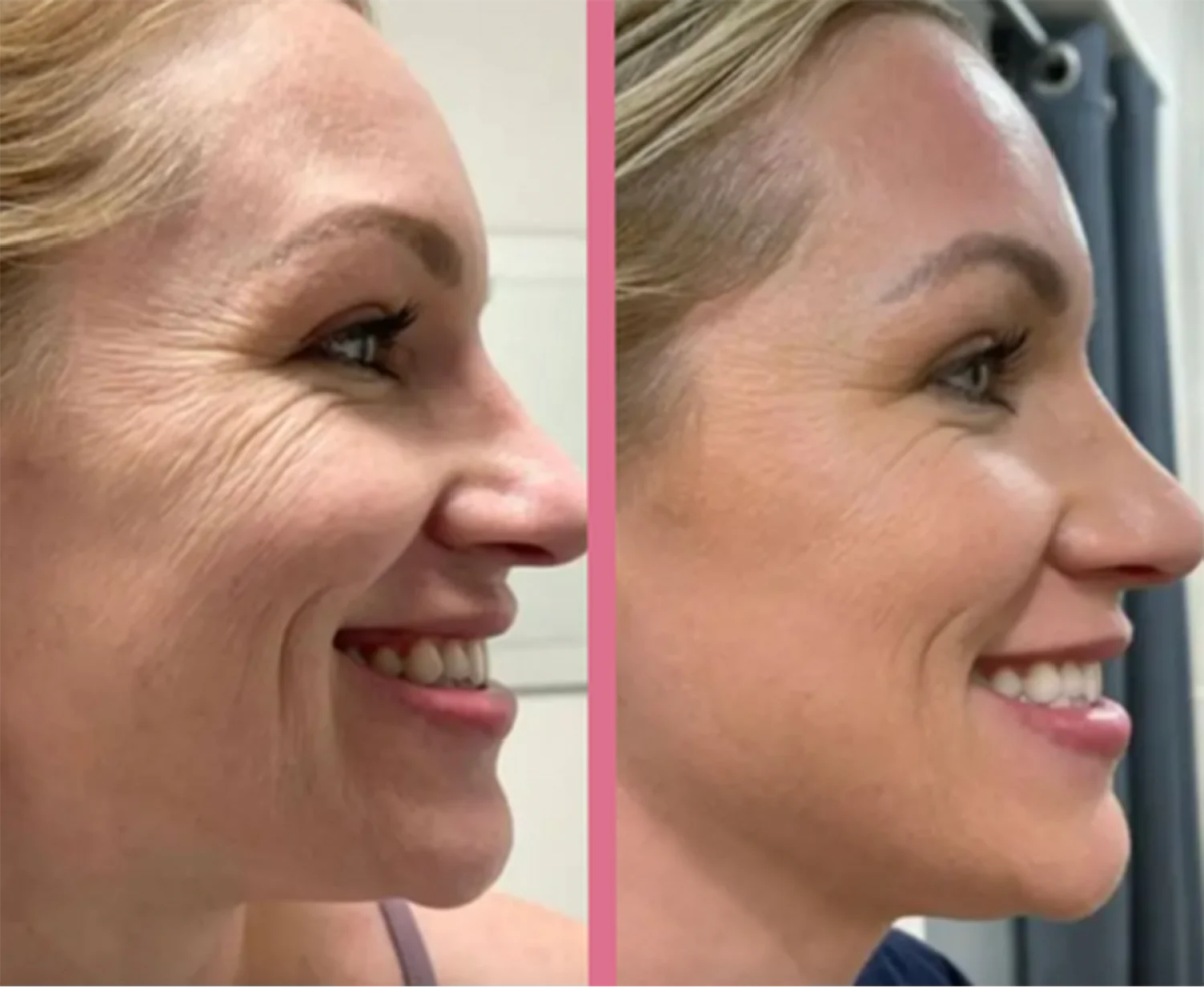 מכשיר עיסוי להרמה וחיטוב של הפנים | Face Neck Lifting | אוזו - שופ