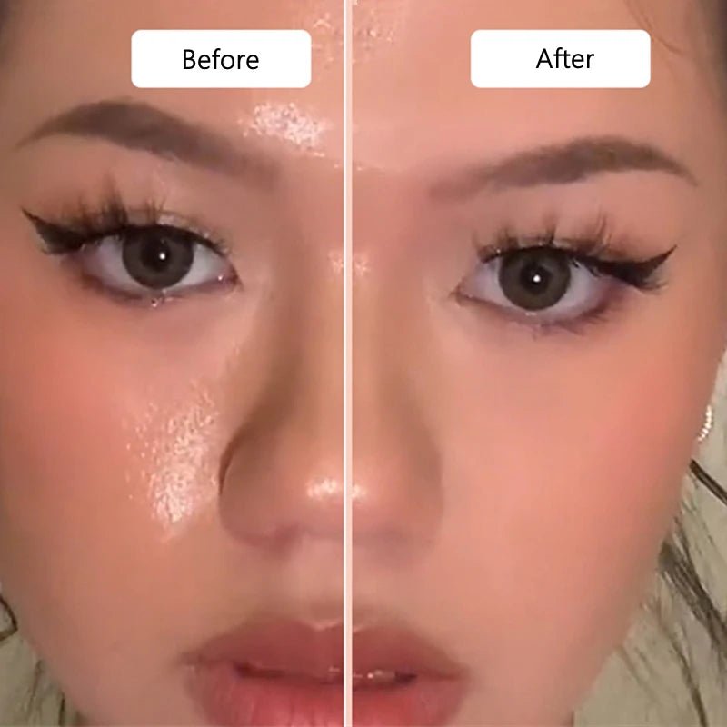 רולר וולקני לנטרול שמנוניות בפנים - 2 יחידות | Oil Control Rolling Stone | אוזו - שופ