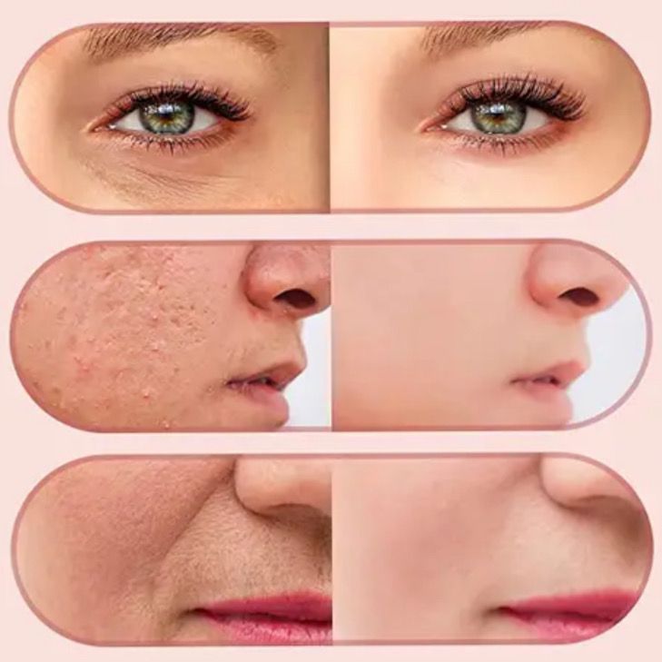 שרביט הקסמים - מעלים כל פגם על הפנים | | אוזו - שופ